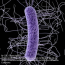 Studiu de caz DIAREE CU CLOSTRIDIUM DIFFICILE